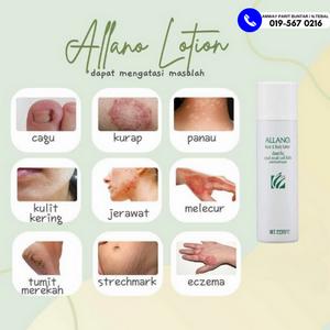 Allano Lotion Amway Parit Buntar