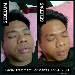 Facial Treatment For Men's